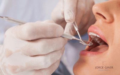 Afinamiento facial: las bolas de Bichat