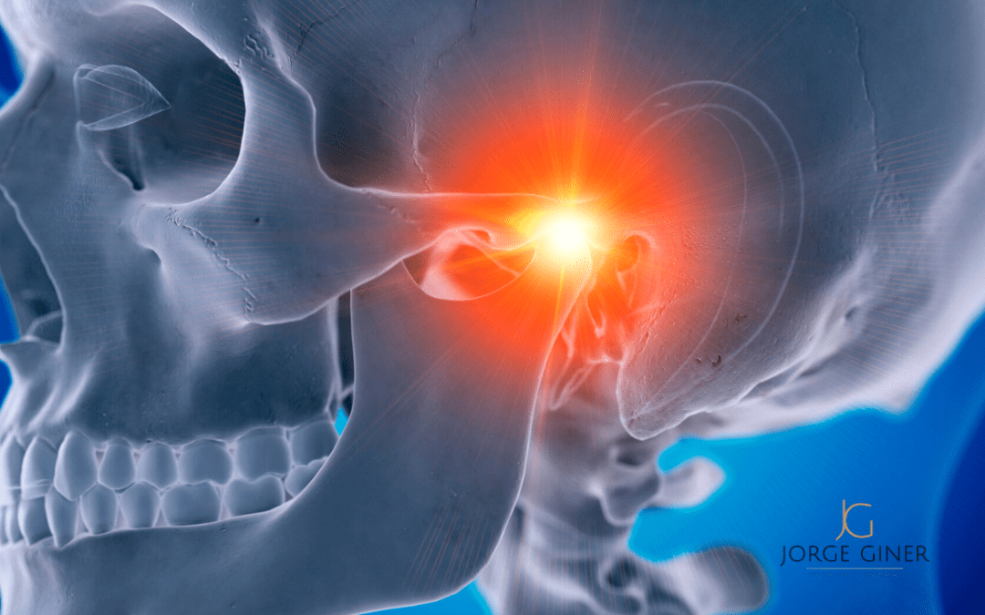 Osteoartrosis de la articulación temporo mandibular